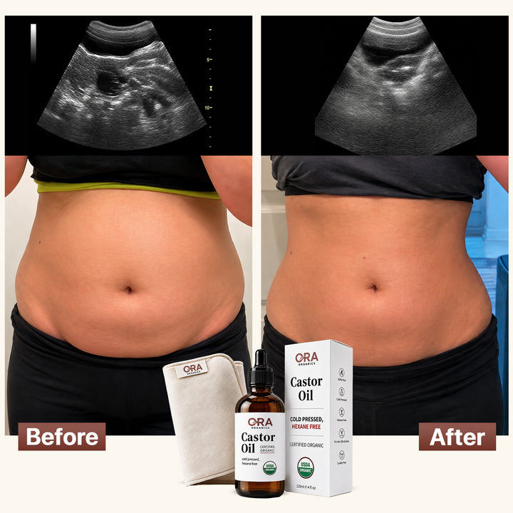 Castor Oil Detox Pack