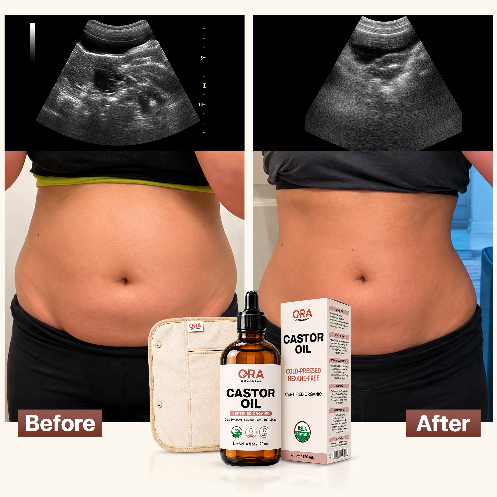Castor Oil Bundle Pack